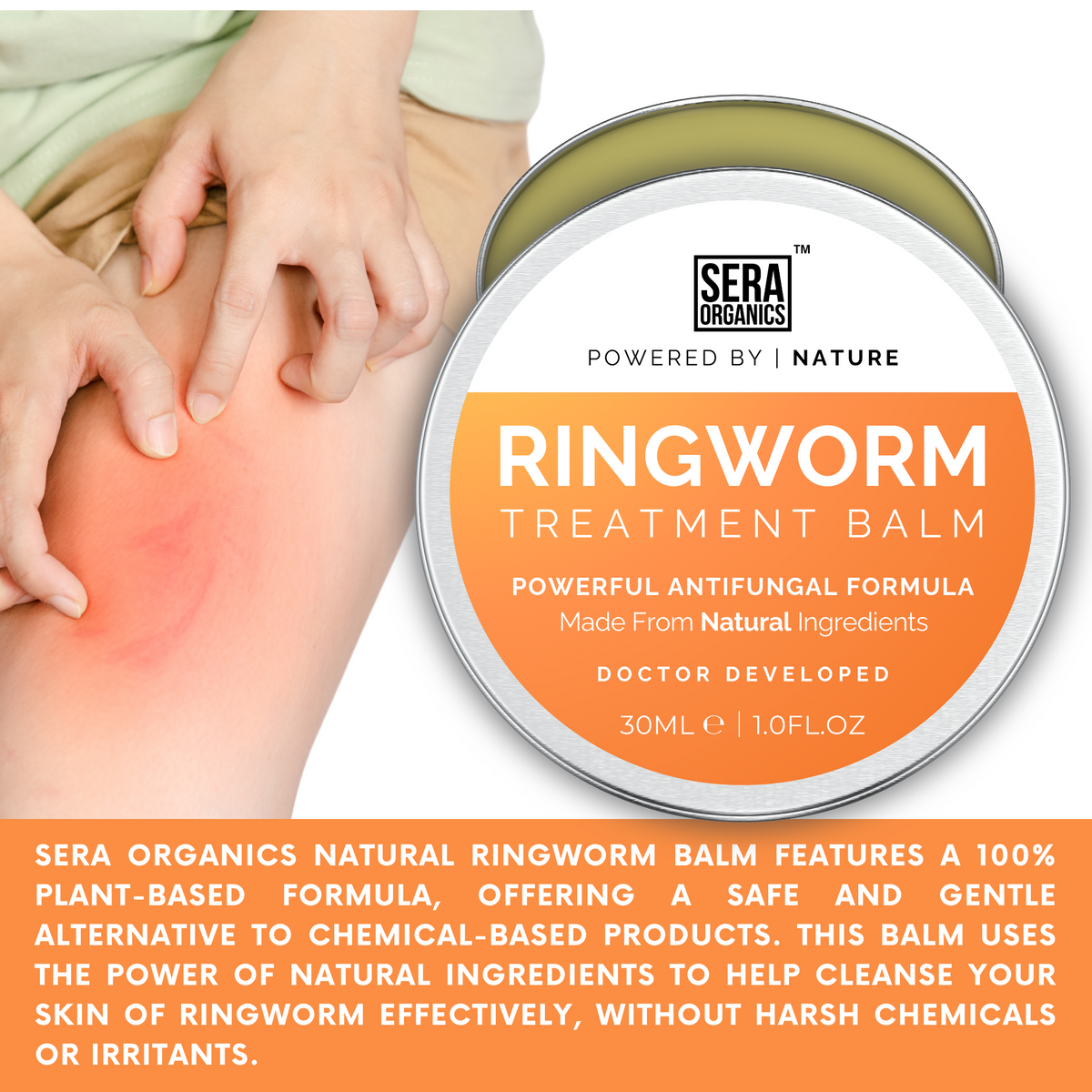 Ringworm Antifungal Cream